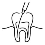 Endodoncja