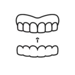 Ortodoncja nakładkowa